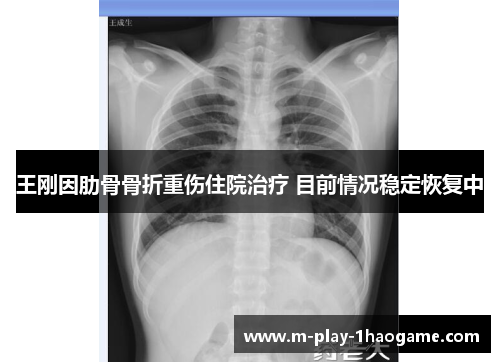 王刚因肋骨骨折重伤住院治疗 目前情况稳定恢复中 王刚因肋骨骨折重伤住院治疗 目前情况稳定恢复中